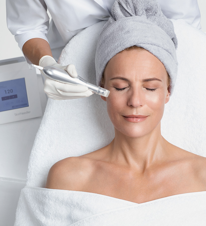 Microneedling-2
