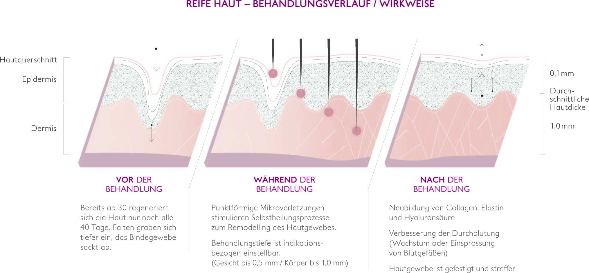Skinneedler_vor_waehrend_nach_behandlung
